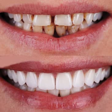 Slider image (3) Uzmanlar Dental Clinic